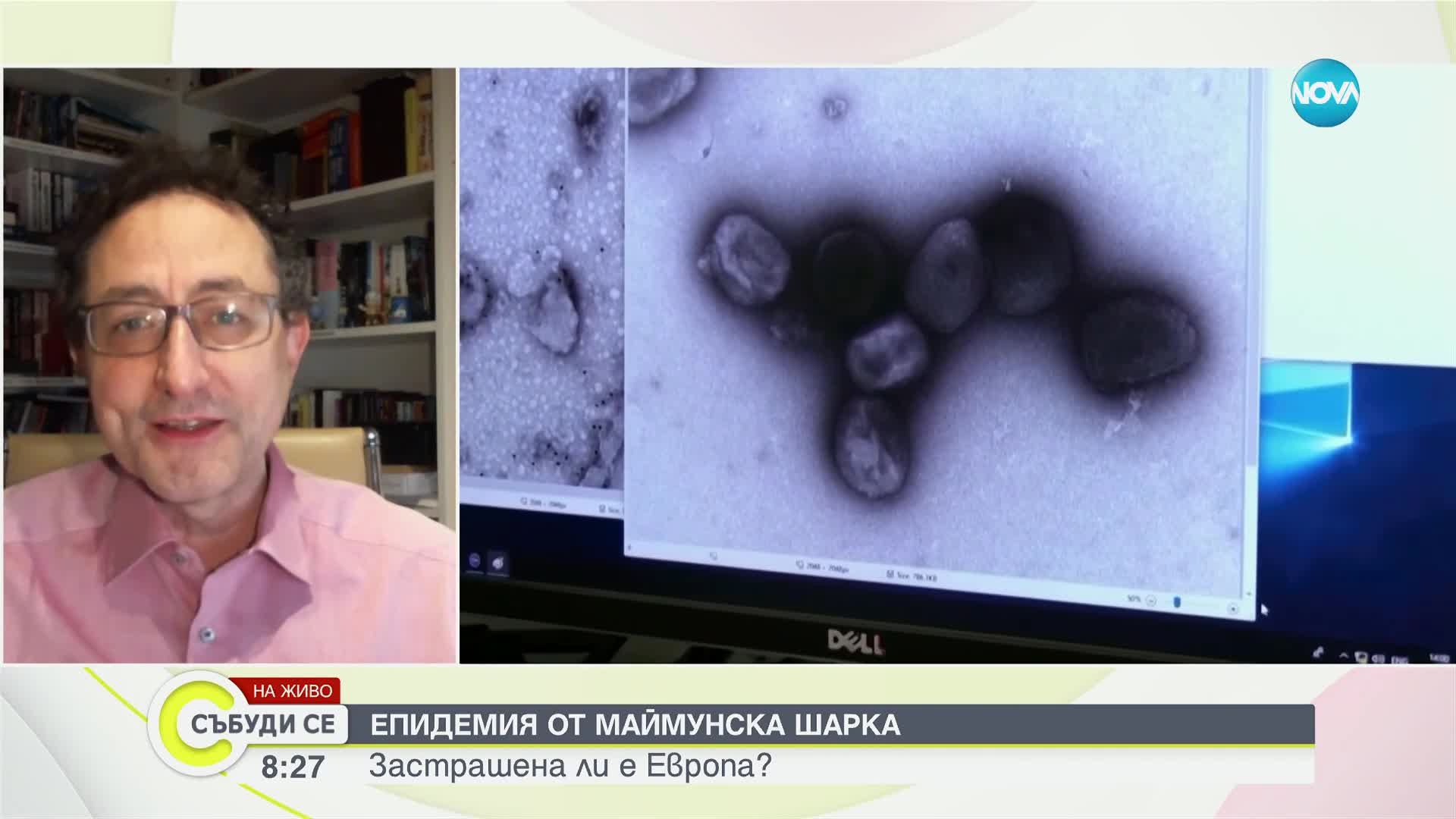 Д-р Аспарух Илиев: Неизбежно маймунската шарка ще се появи и в България
