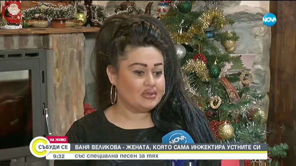 Ваня Великова - Жената, която сама инжектира устните си със специална песен за тях