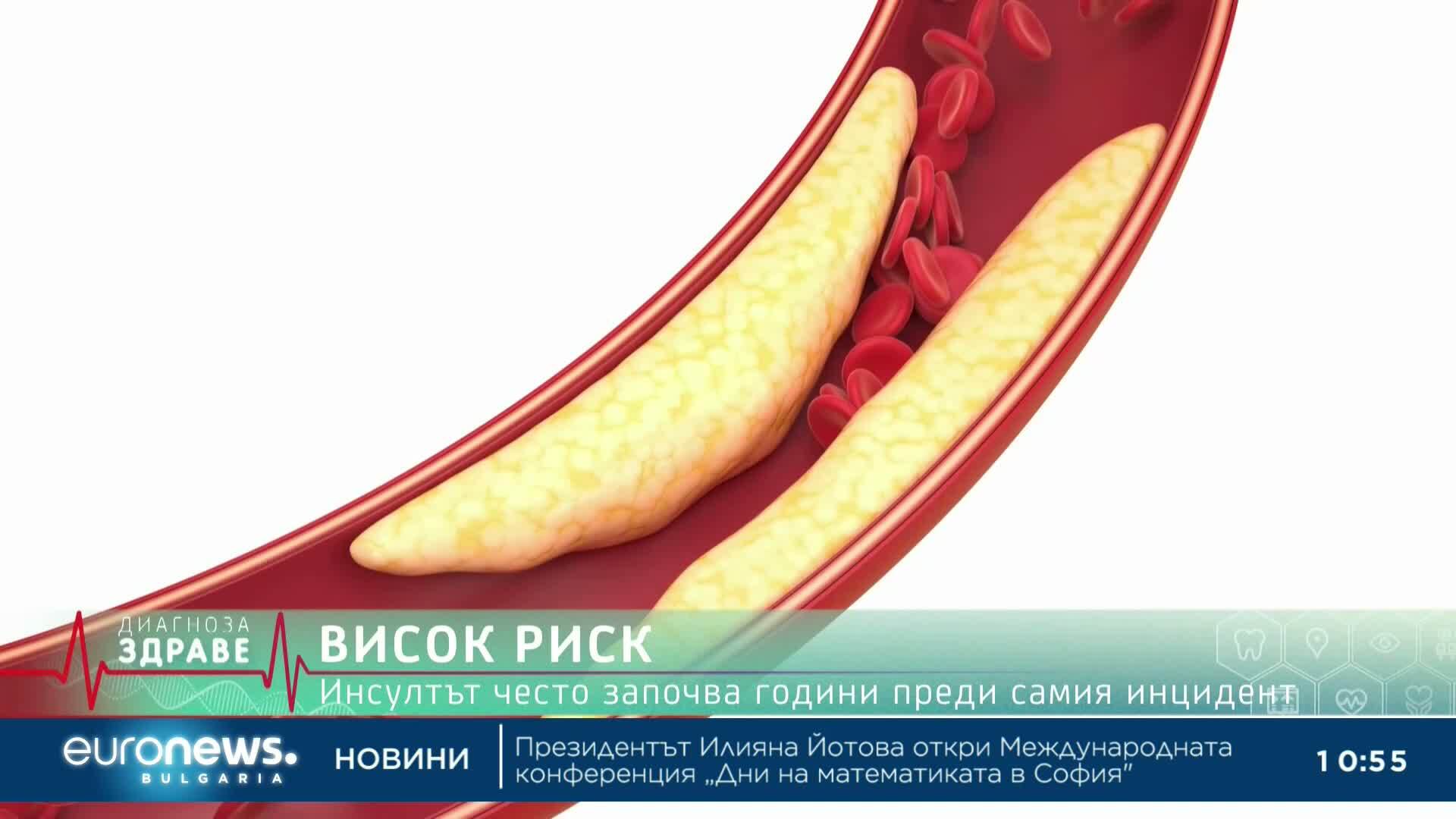 „Диагноза: Здраве“, еп. 77: Витамин D – колко ни е необходим и как да предпазим мозъка си