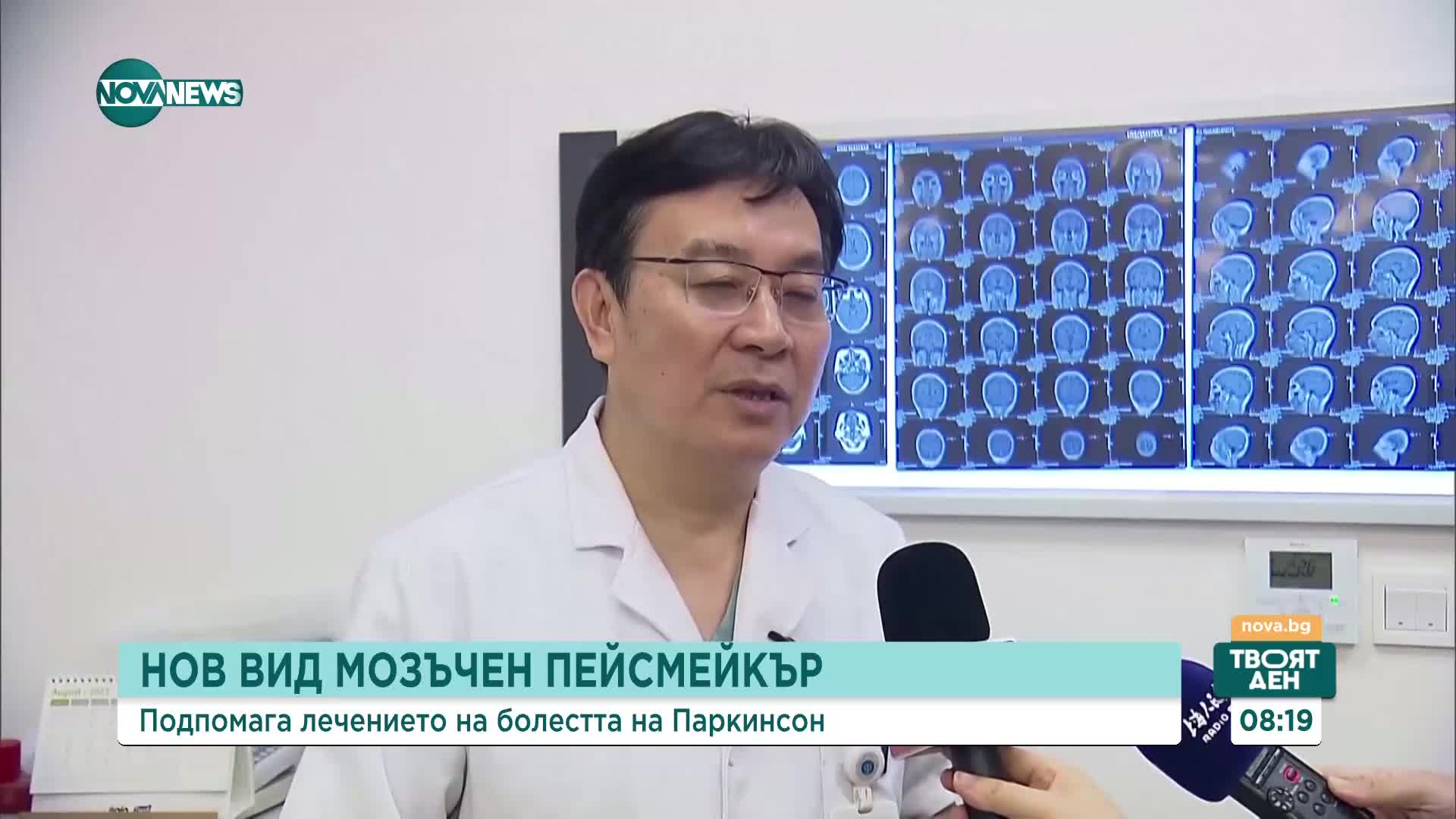 Нов вид мозъчен пейсмейкър