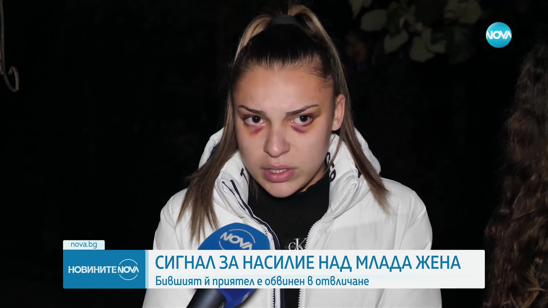„Казваше, че ще умра“: Млада жена беше отвлечена и жестоко пребита от бившия си приятел