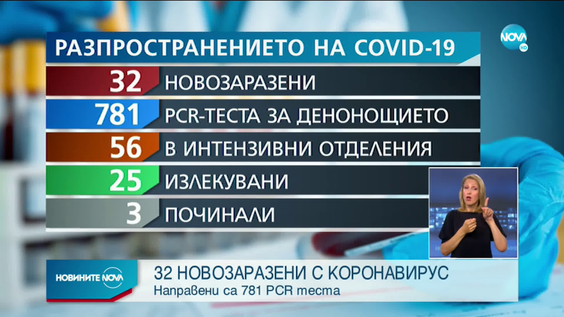 32 нови случая на COVID-19 у нас