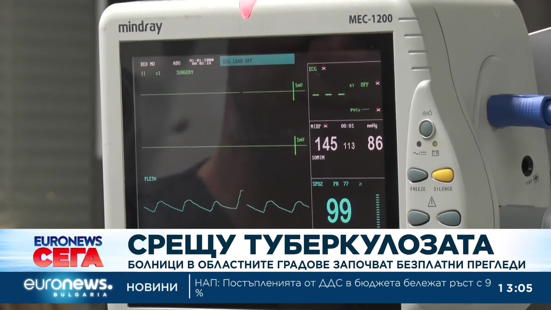 Болници в областните градове започват безплатни прегледи за туберкулоза