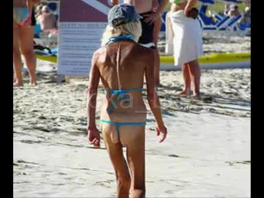 15 най - ужасни слънчеви изгарания на лято 2009!!!