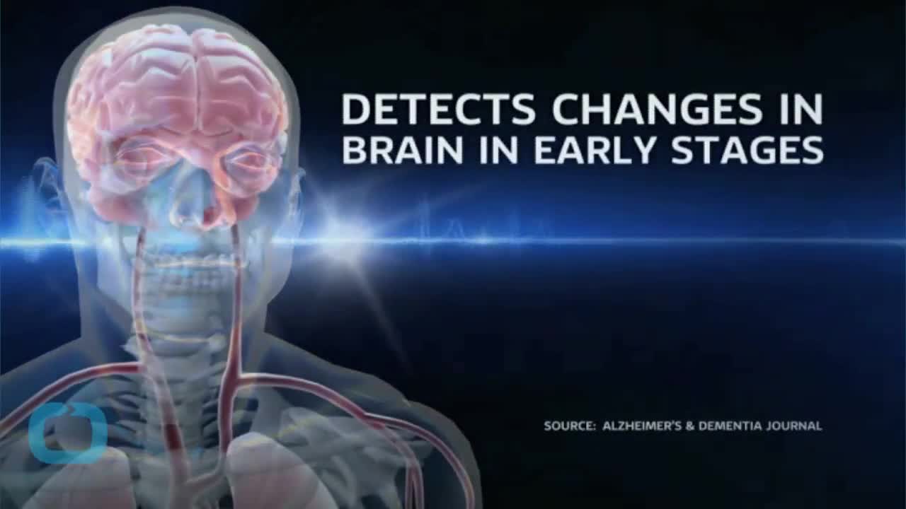Учените смятат, че Алцхаймерът е заложен в човешката еволюция