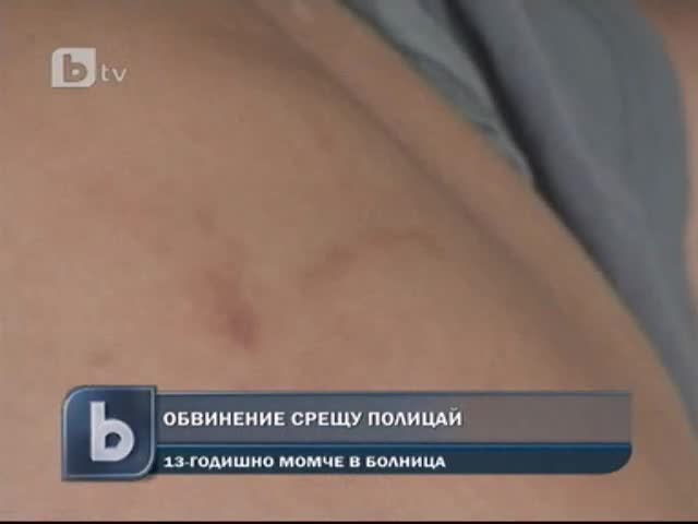 Ученик зверски пребит от служител на реда 