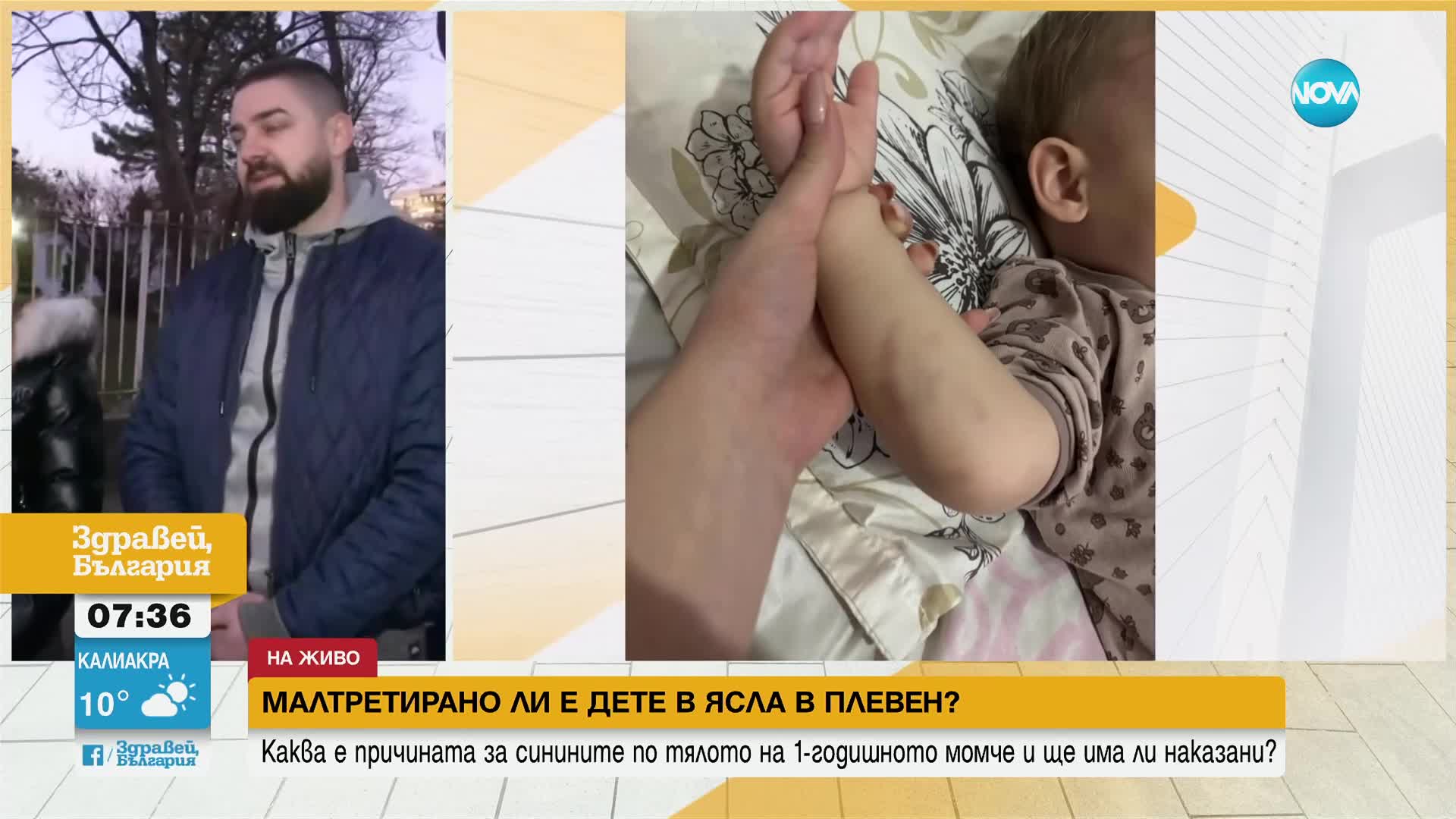 Родители твърдят, че детето им е малтретирано в детска ясла