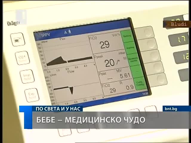 Медицинско чудо! Бебе родено от извънматочна бременност
