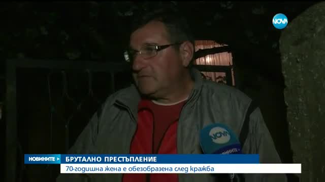 70-годишна жена - обезобразена след кражба