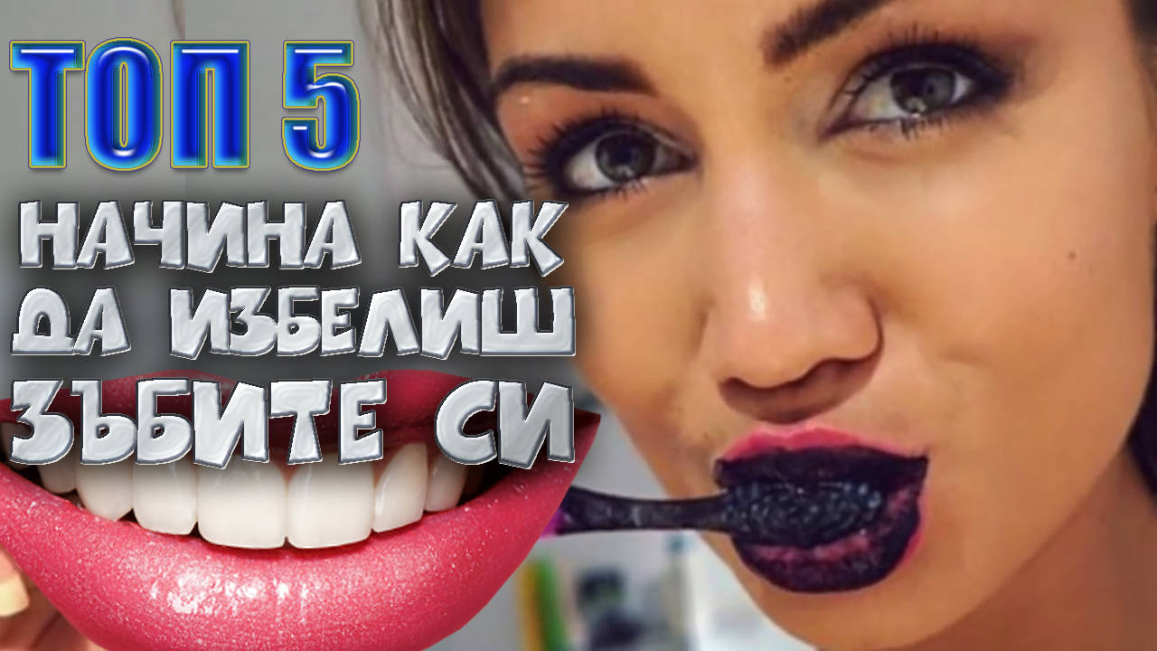 Топ 5 начина как да избелиш зъбите си