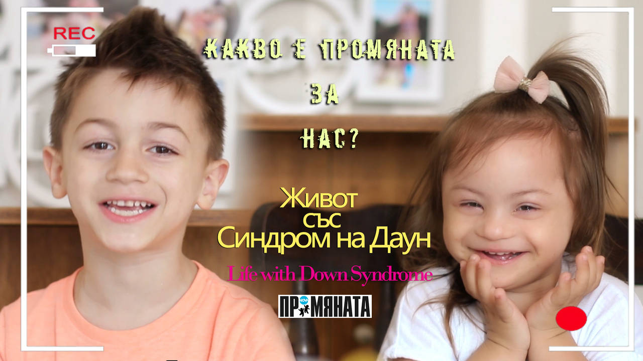 Какво е промяната за нас? Живот със Синдром на Даун
