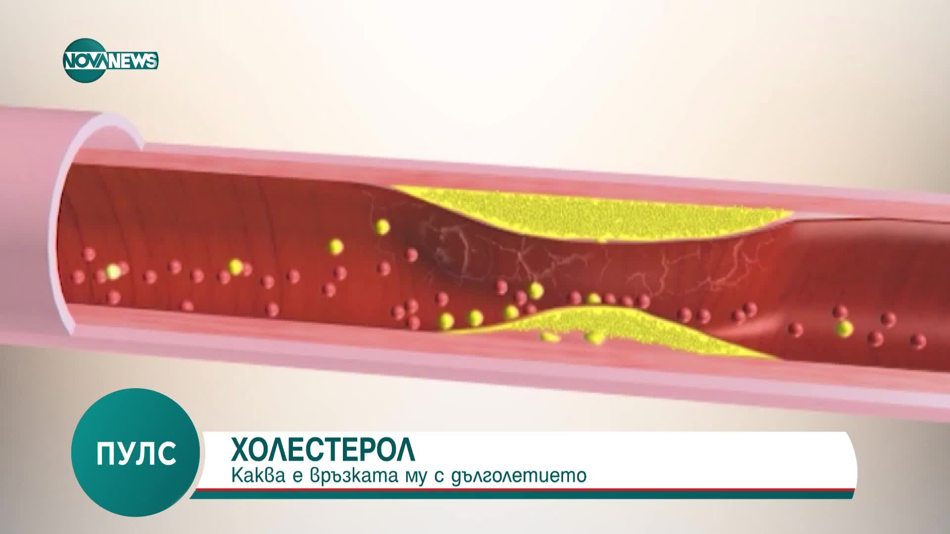 Каква е връзката на холестерола с дълголетието