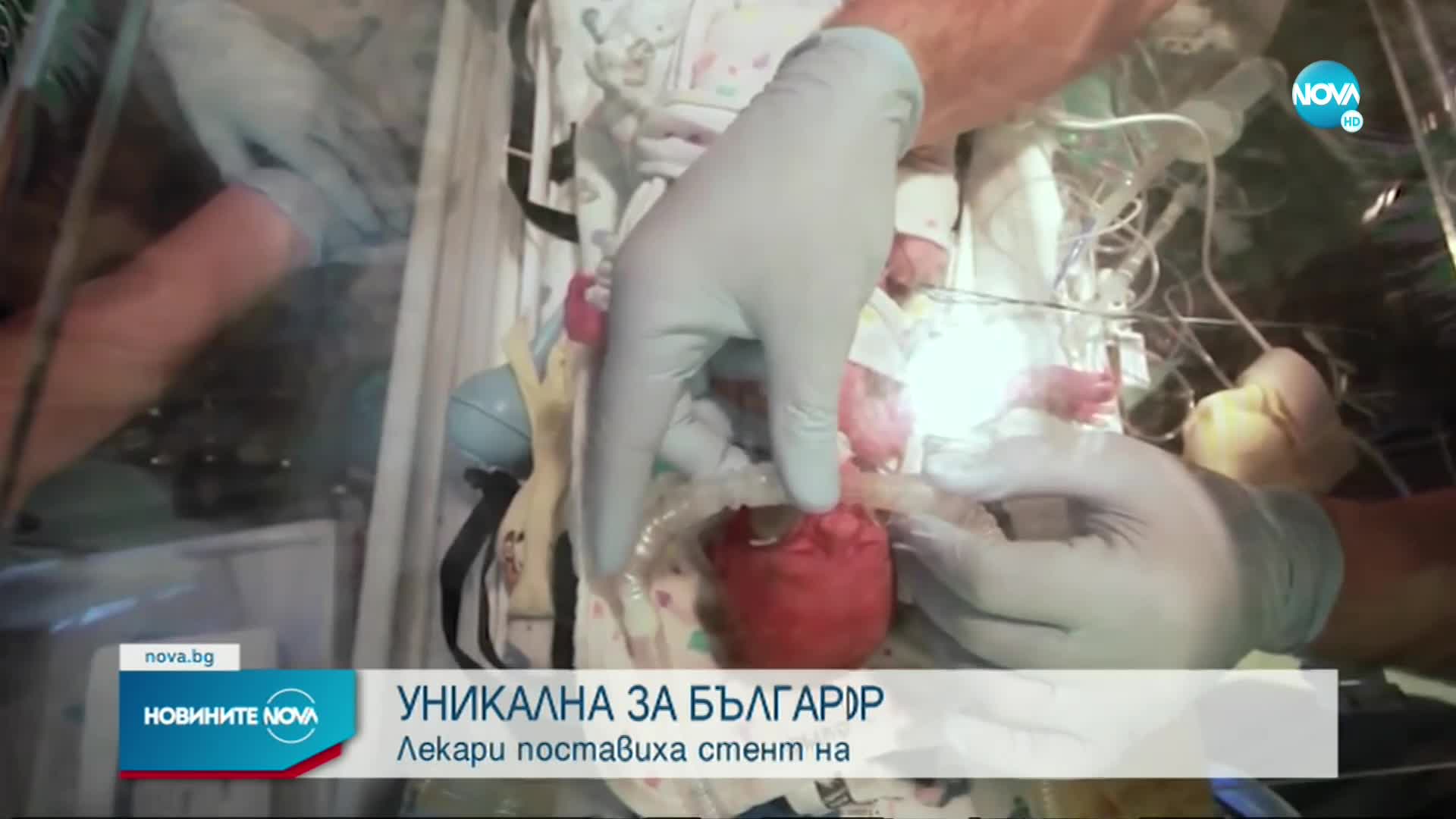 Уникална за България операция: Лекари поставиха стент на новородено