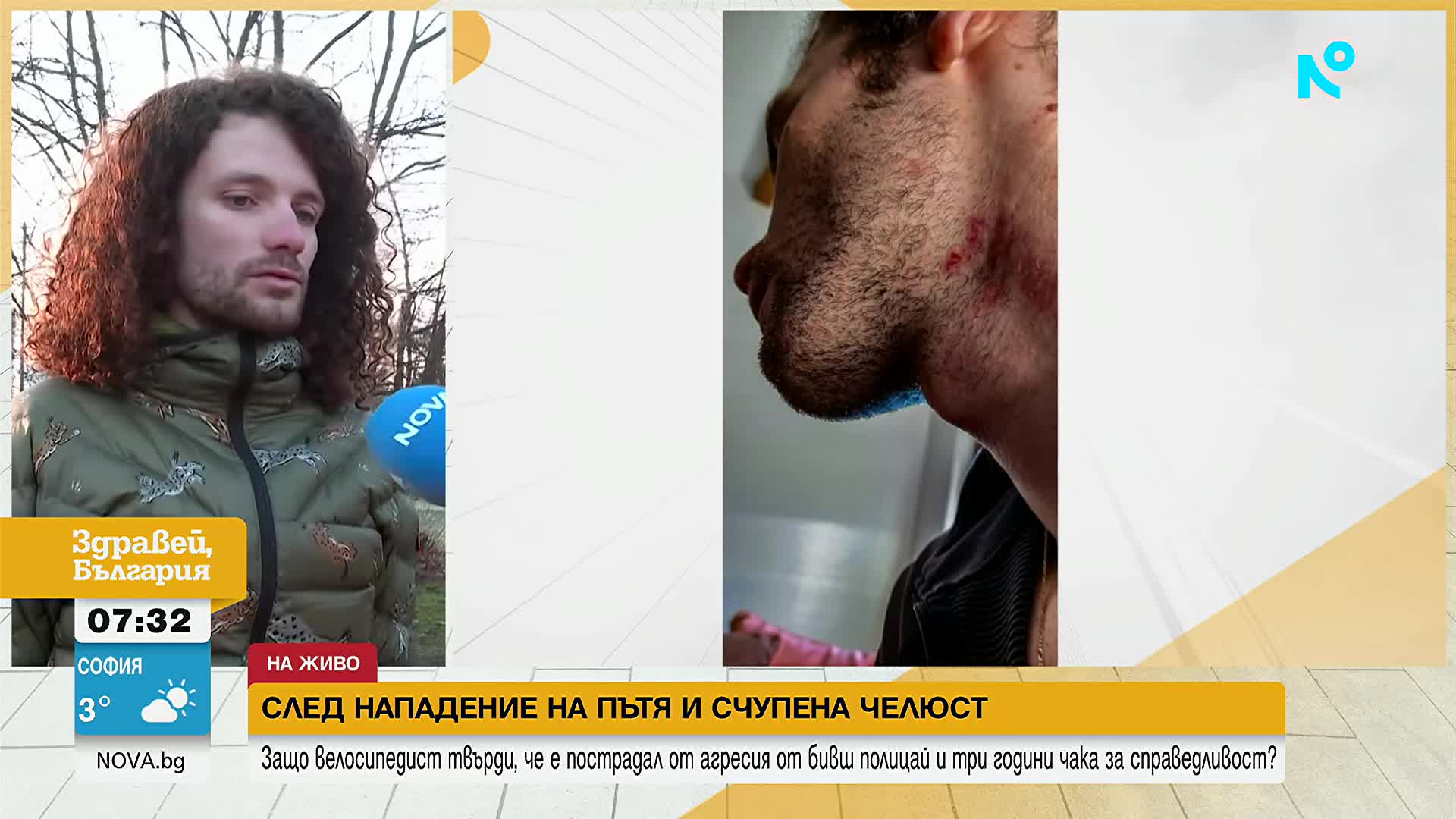 След агресия на пътя и счупена челюст: Мъж твърди, че е нападнат от бивш полицай и три години чака с