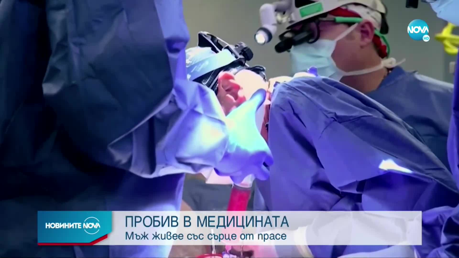 Aмериканец стана първият човек със сърце от генно-модифицирано прасе