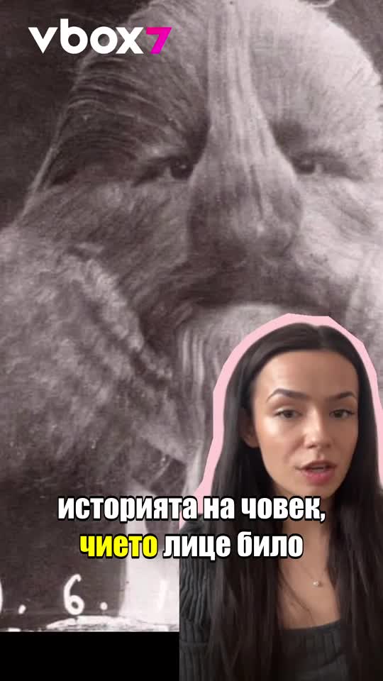 🎪 Трагичната съдба на "Лионел, човекът с лъвско лице" 🦁💔