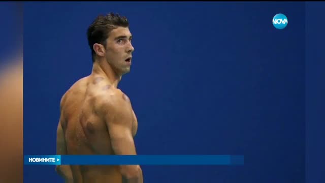 От какво са странните петна по телата на някои спортисти в Рио?
