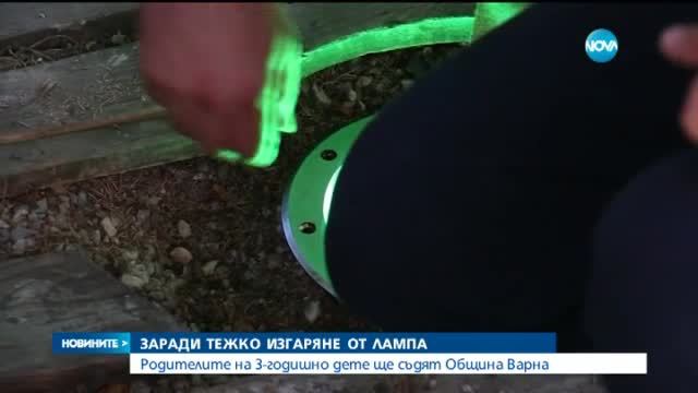 Дете е с тежко изгаряне на ръката от лампа в Морската градина