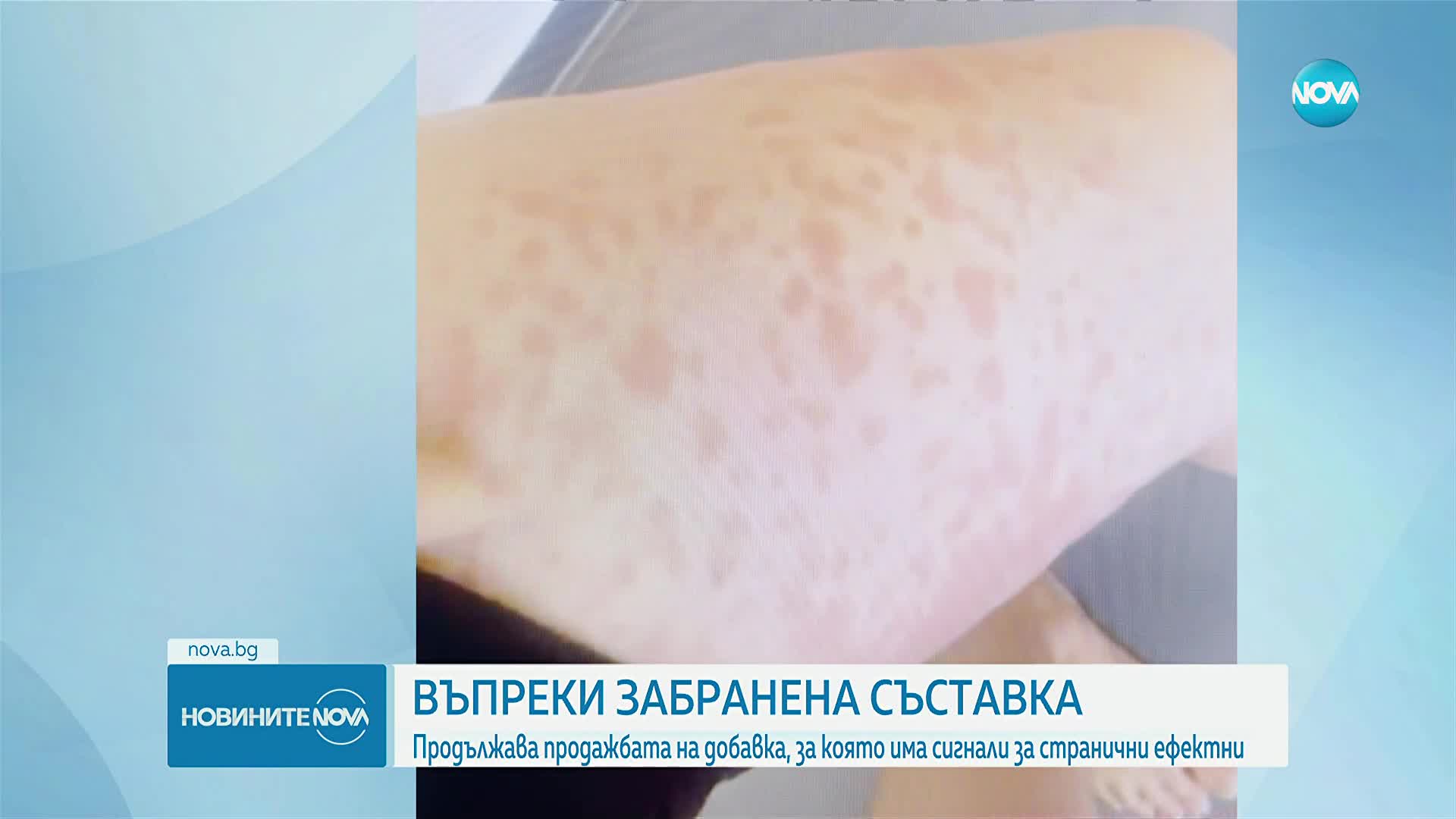 „Високо напрежение”: Какво съдържат добавките за отслабване, заради които десетки жени са в болница
