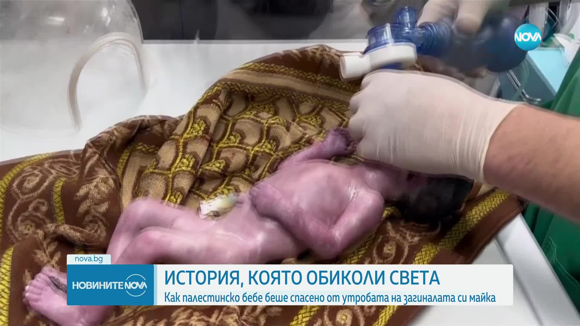 ЖИВОТ СРЕД СМЪРТ: Спасиха бебе от утробата на майка при въздушен удар в Газа