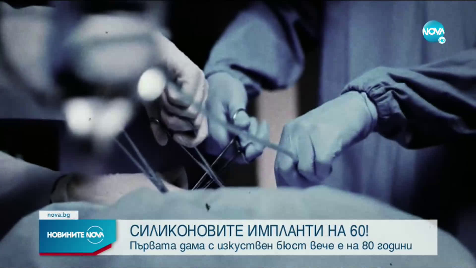 Силиконовите импланти на 60