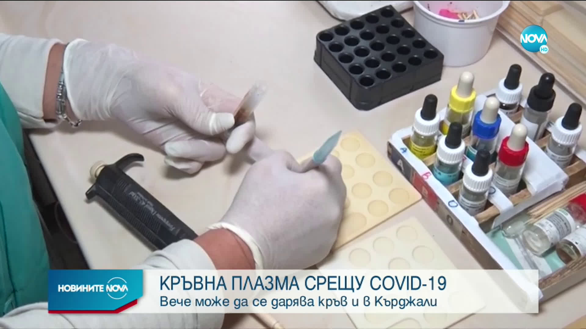 Преболедували COVID-19 ще могат да даряват кръв за плазма в Хасково и Кърджали
