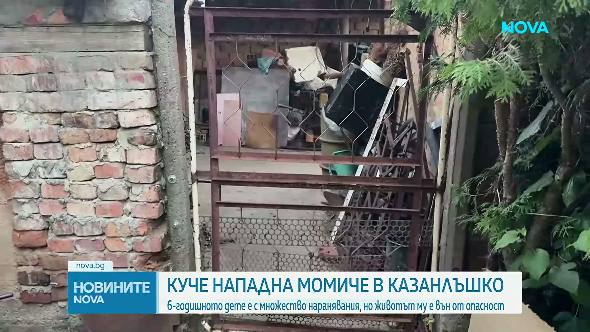 Какво е състоянието на детето, нападнато от Кане Корсо