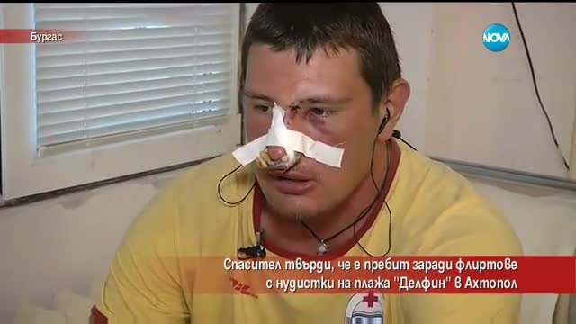 Спасител твърди, че е пребит заради флиртове с нудистки