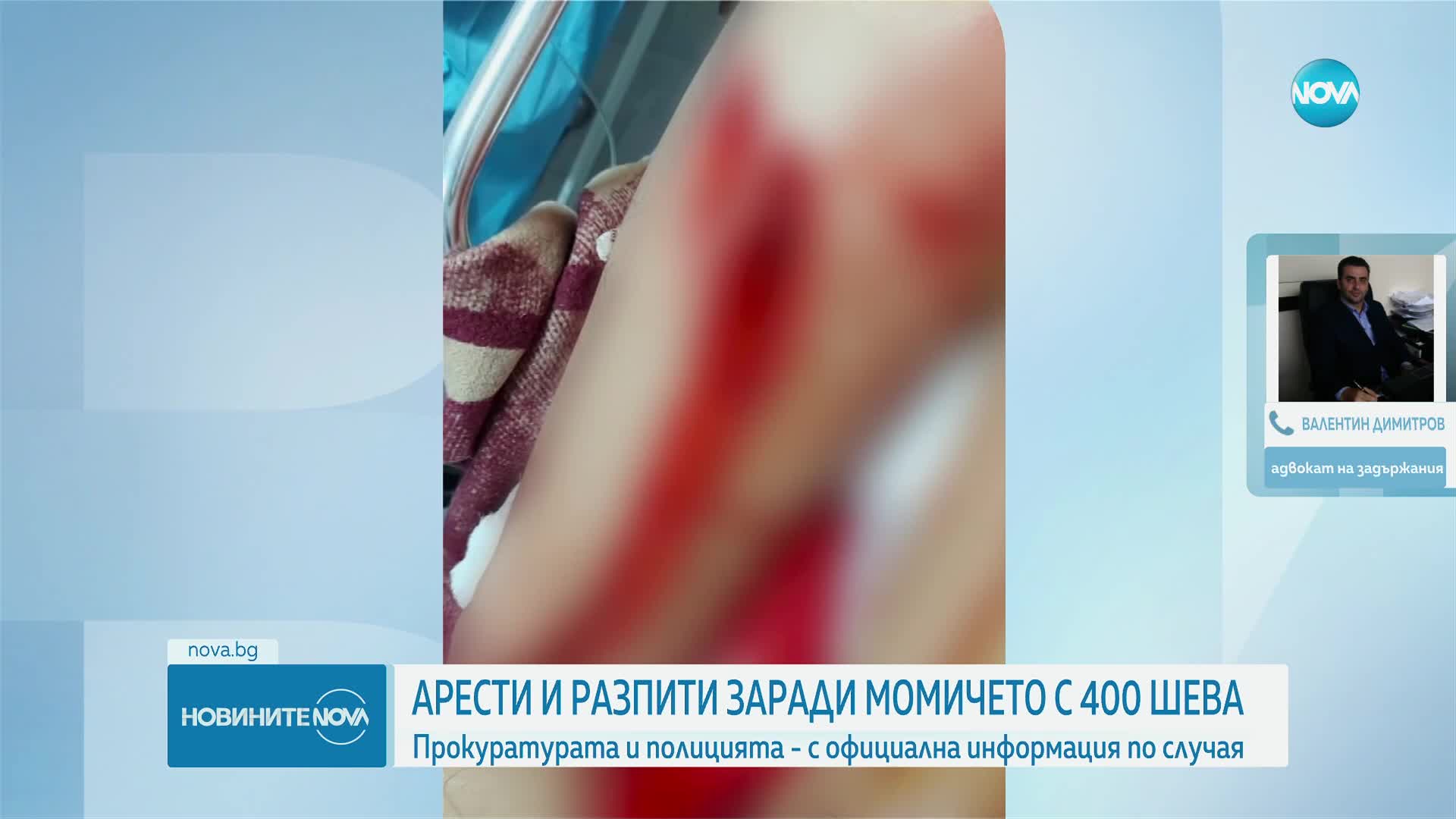 СЛЕД 400 ШЕВА: Арести и разпити заради момичето, рязано с макетен нож