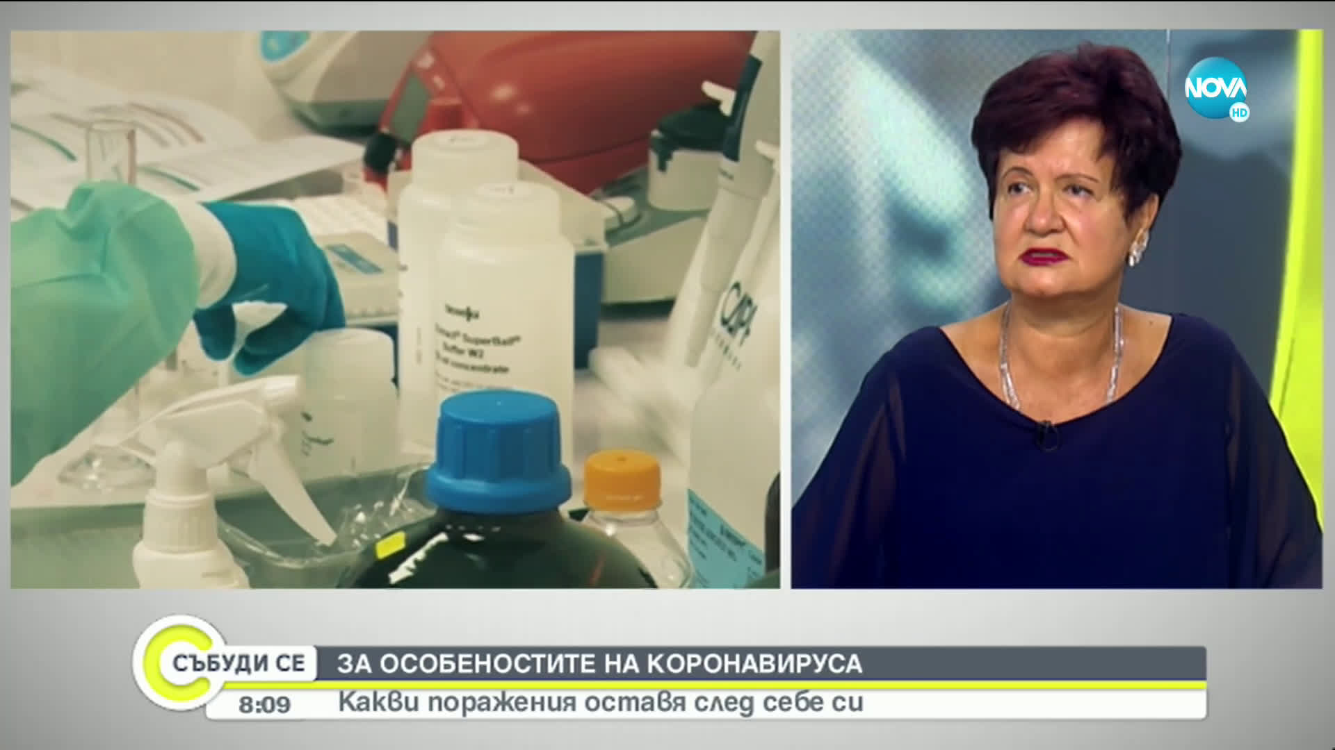 Лекар: Кръвната захар на диабетици, заразени с COVID-19, трябва да е близка до нормалните