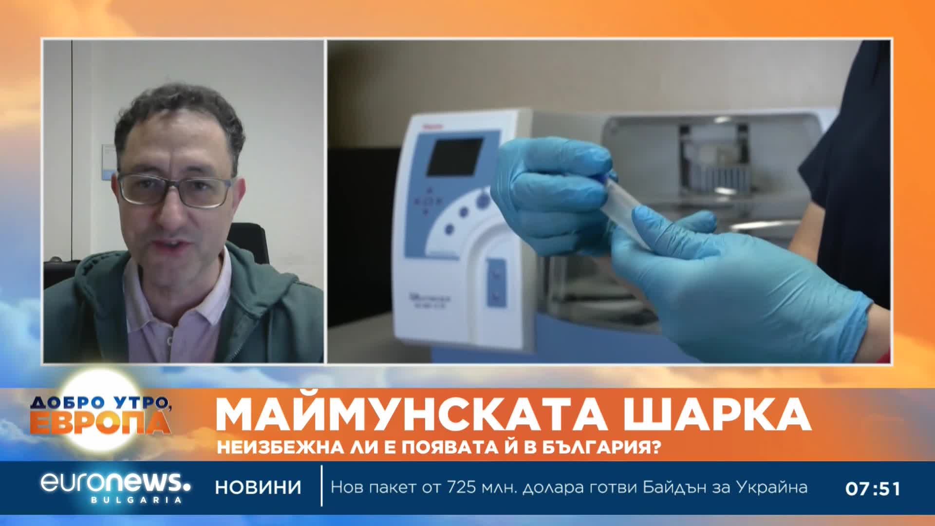 Д-р Аспарух Илиев: Не се очаква да има голяма вълна на заболели от маймунска шарка