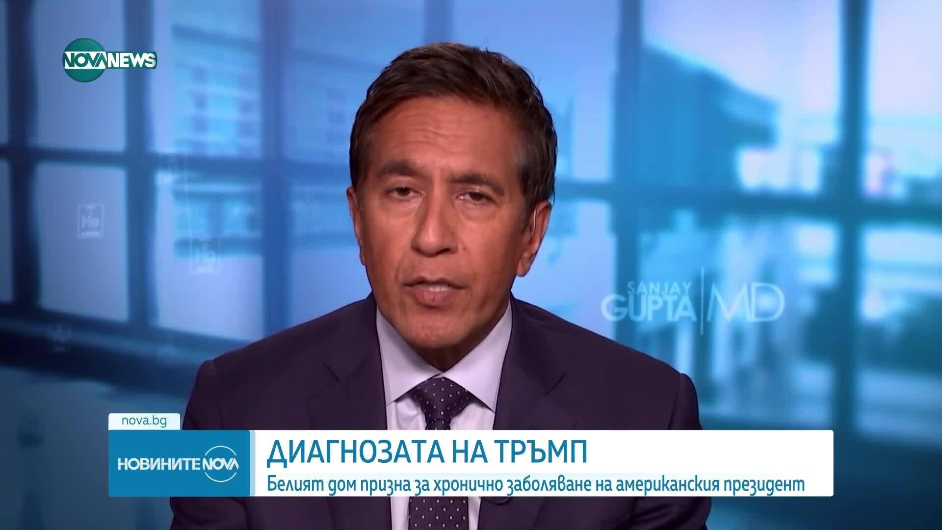 Тръмп е диагностициран с хронична венозна недостатъчност