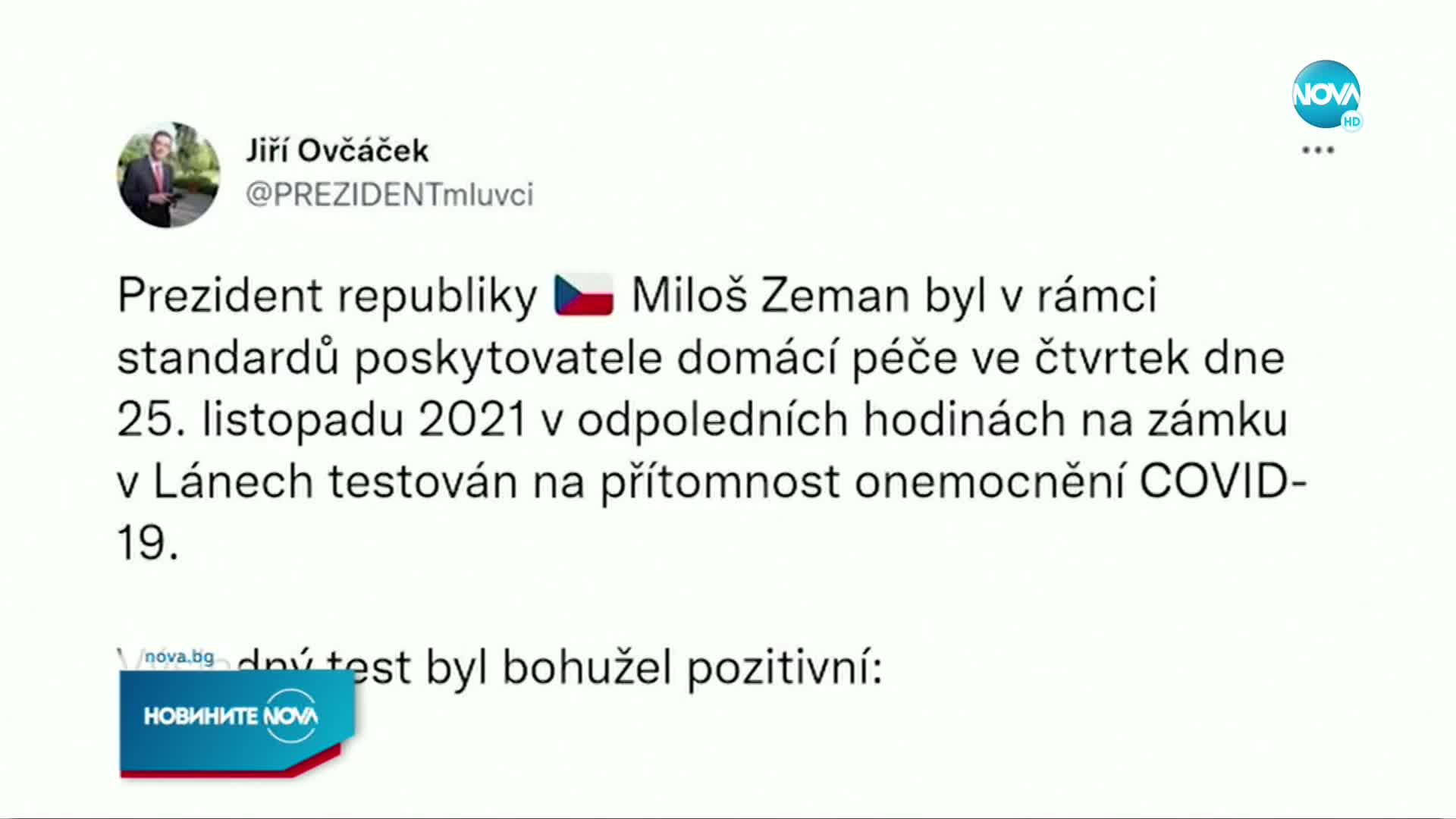 Милош Земан отново бeше приет в болница