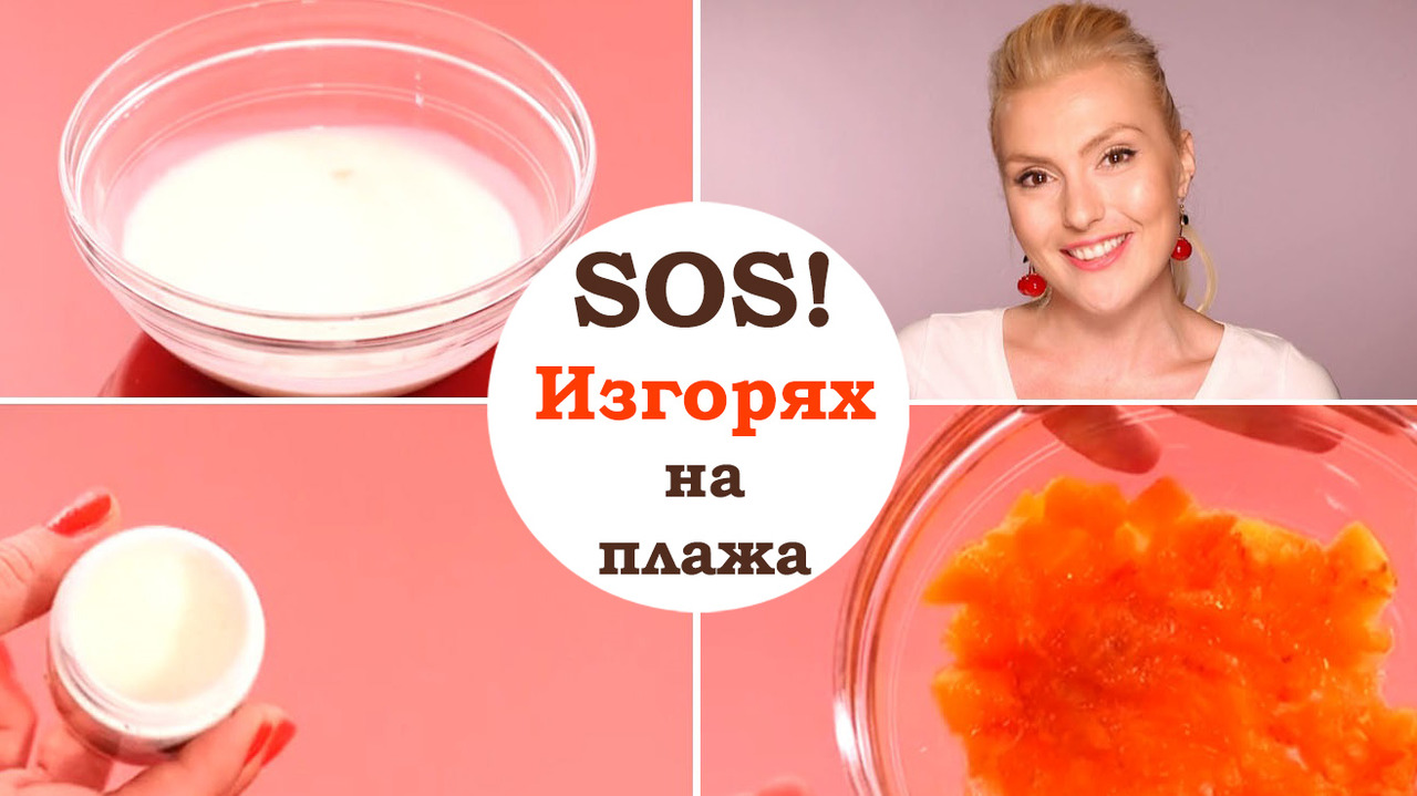 SOS! Изгорях на плажа - домашни трикове срещу болката