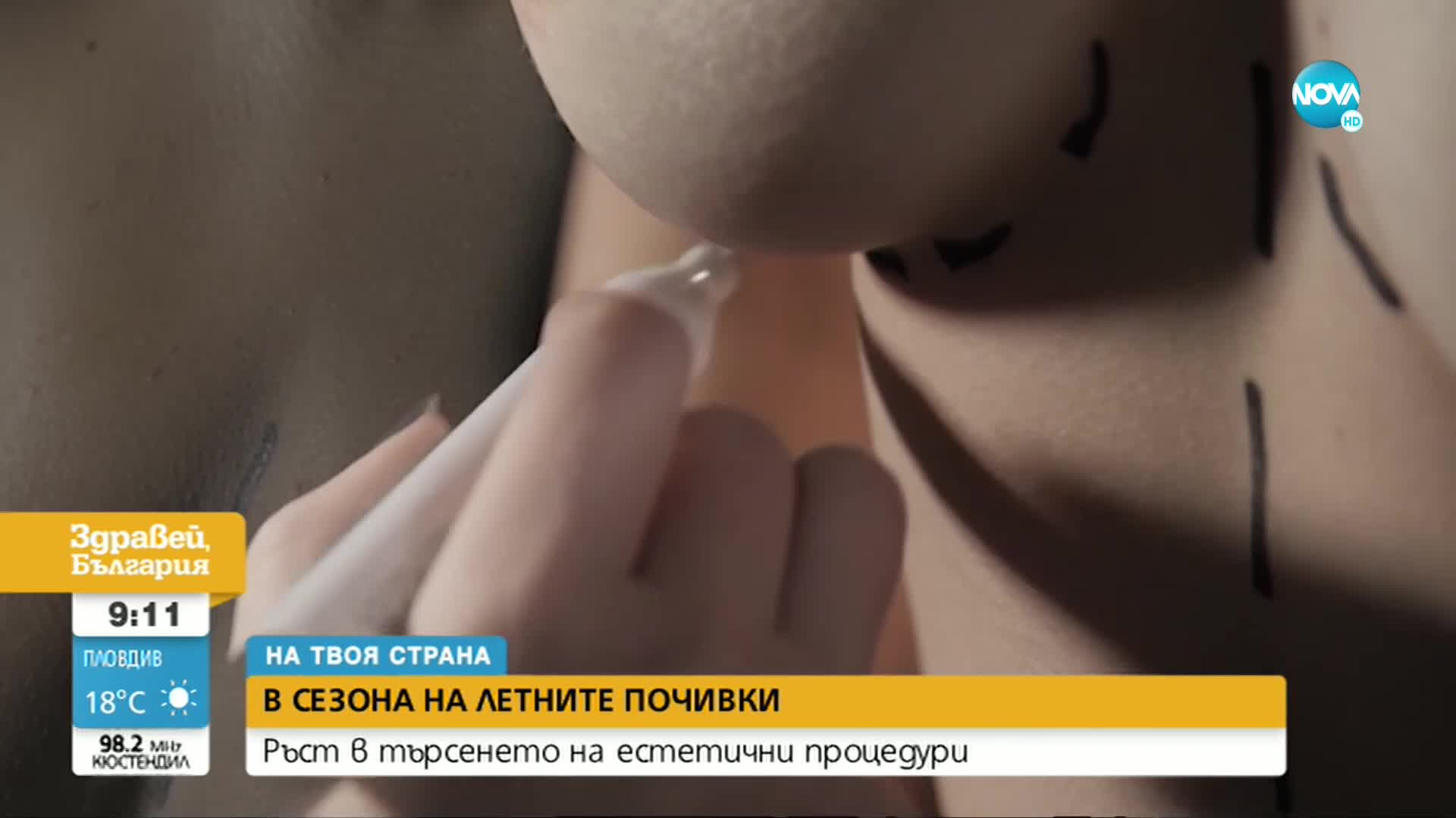 „На твоя страна”: Ръст на търсенето на естетични процедури в началото на лятото