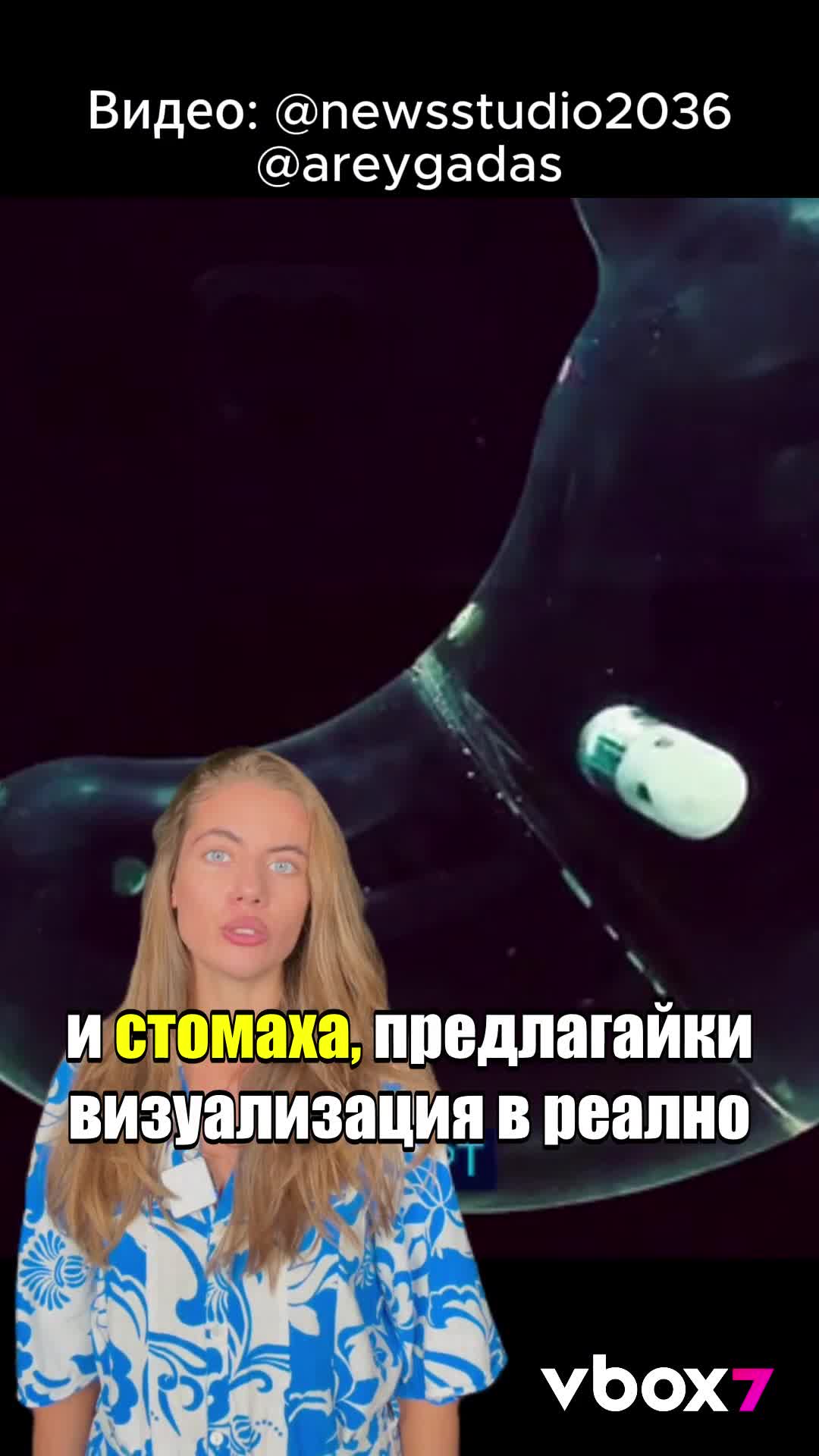 Мъж погълна хапче-камера! Какво се случи?