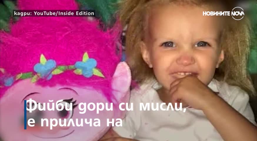 Дете страда от Синдрома на невъзможната за сресване коса