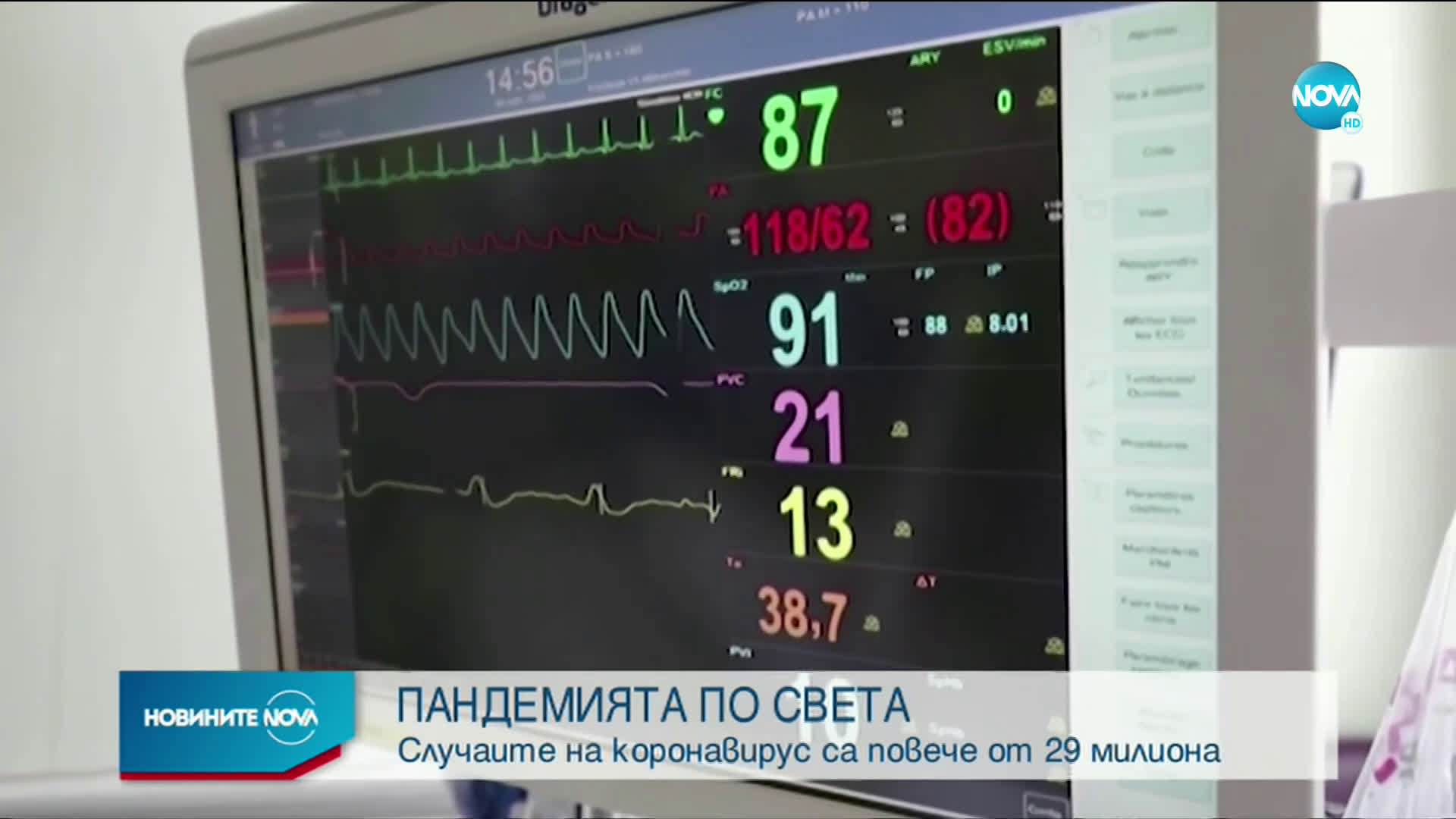 Случаите на коронавирус по света са повече от 29 милиона