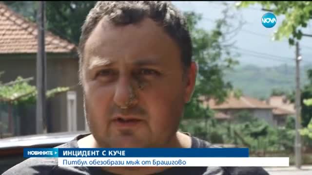 Побеснял питбул отхапа лицето на мъж в Брацигово
