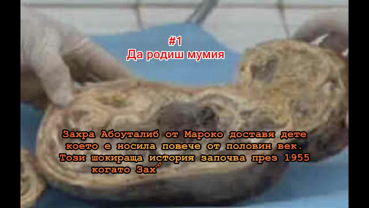 Топ 7 Най-шокиращи медицински истории