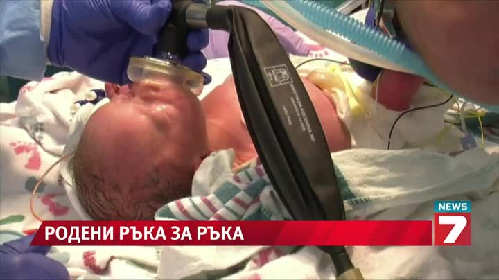Близнаци се родиха, хванати за ръце