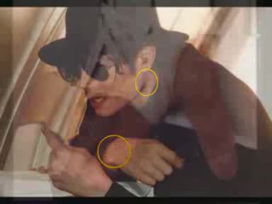 Болестта на Michael Jackson