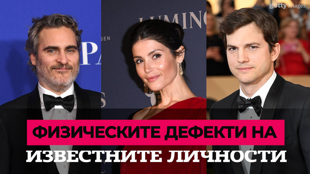 Звезди, които споделят открито за своите несъвършенства