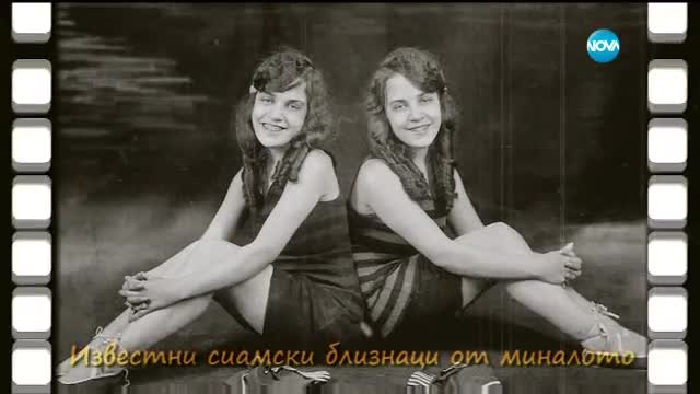 Историята за сиамските близнаци в "Ничия земя" (26.11.2016)