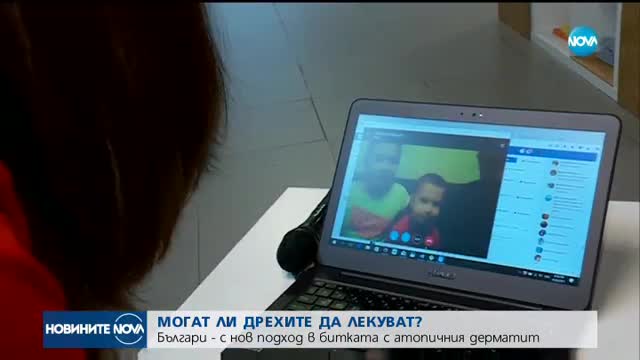 СРЕЩУ АТОПИЧНИЯ ДЕРМАТИТ: Могат ли дрехите да лекуват?