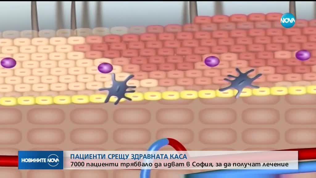 Пациенти срещу Здравната каса заради нови критерии за биологична терапия