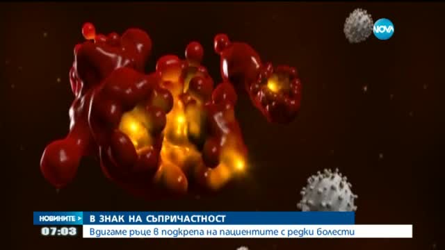 Отбелязваме Световния ден на редките болести