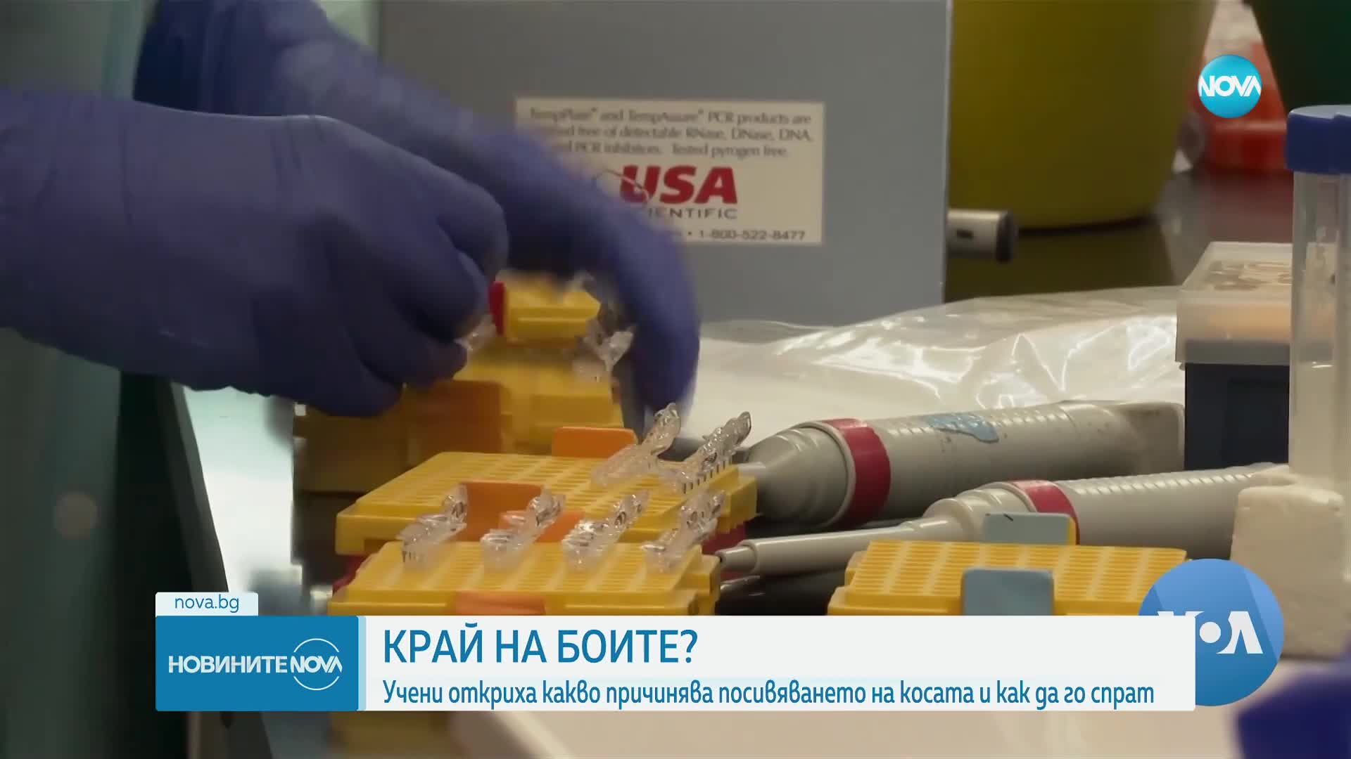 Учени разгадаха защо косата побелява и как да спрат процеса