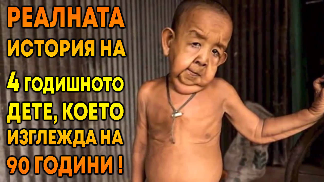 Реалната история на 4 годишното дете, което изглежда на 90 години!