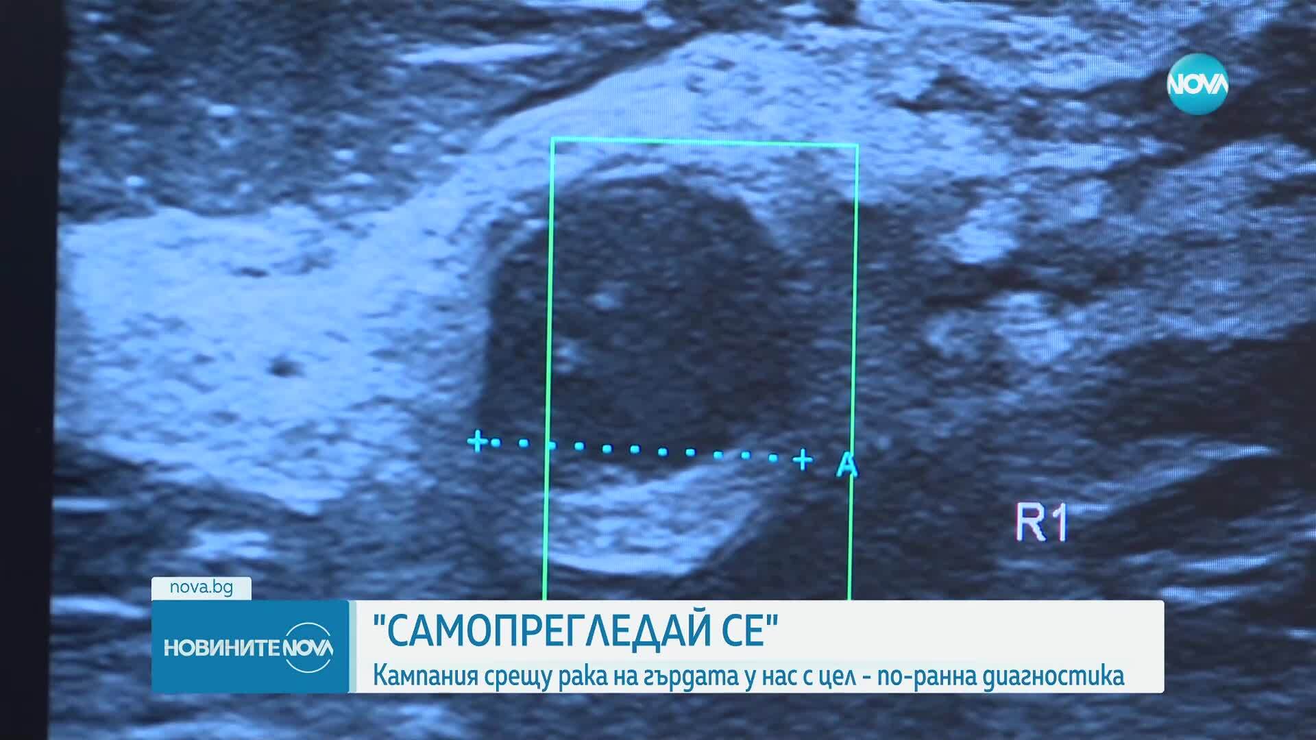 Начало на Националната кампания за борба с рака на гърдата